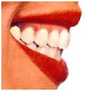 Верхние зубы расположены прямо и поддерживают верхнюю губу